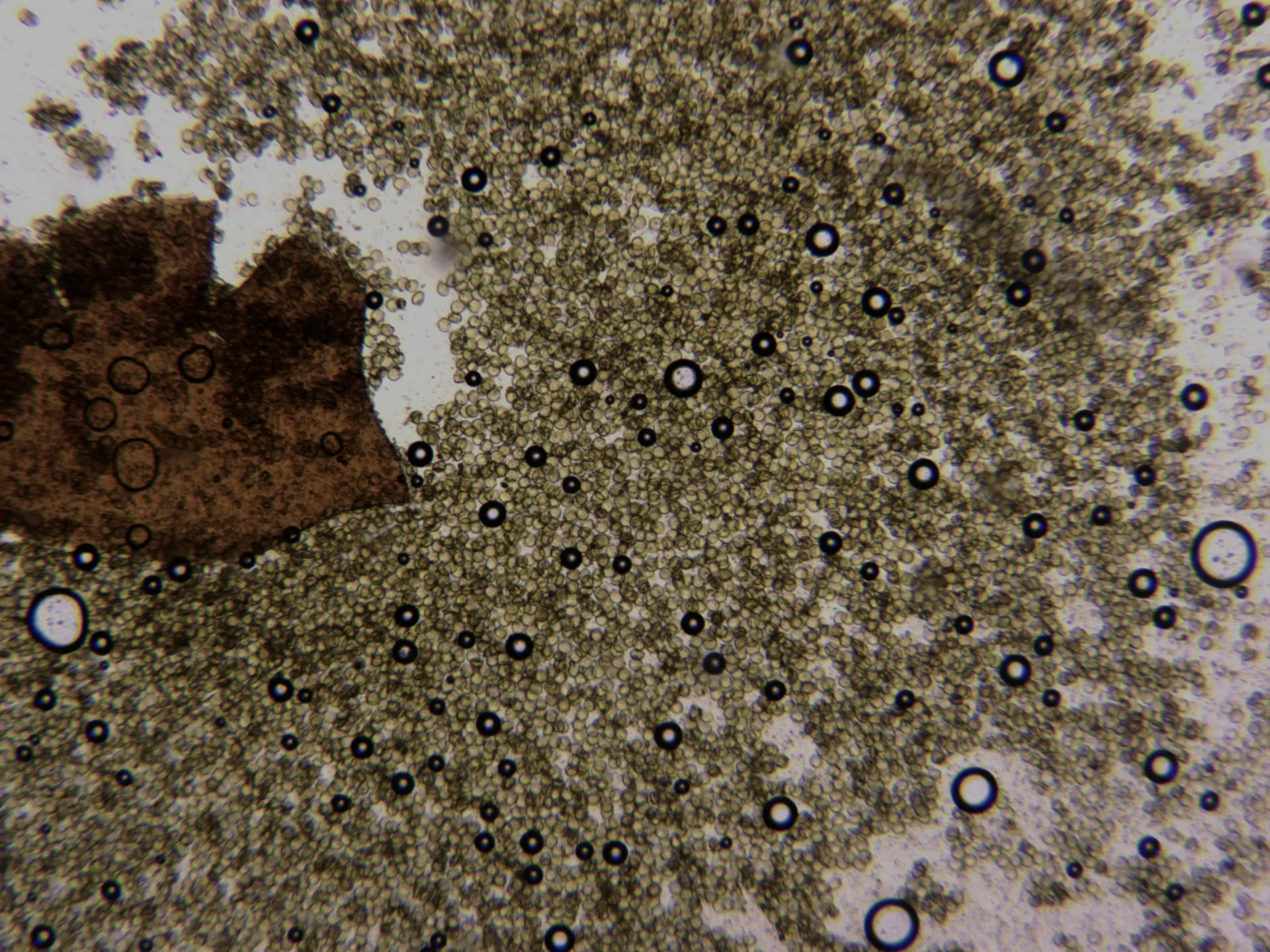 Microscopía de Perichaena corticalis - 10 - Membrana y esporas x 100